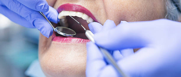Best Emergency Broken Tooth Repair in Princeton, IL